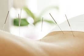 acupuntura en Calpe